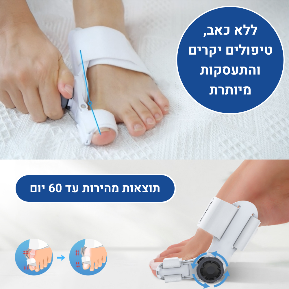 מכשיר הקסם לתיקון בוהן עקומה במהירות